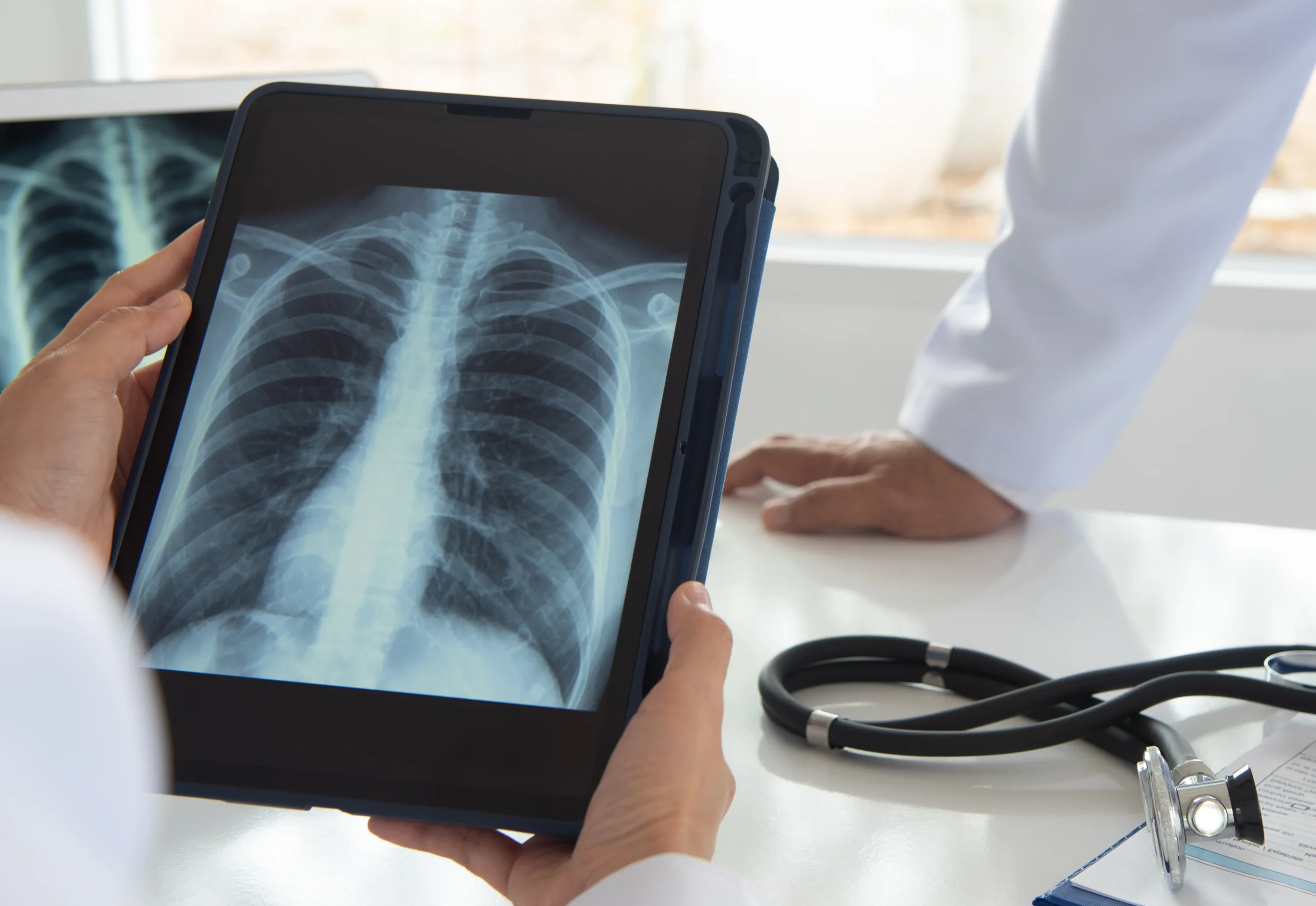 Lung Cancer