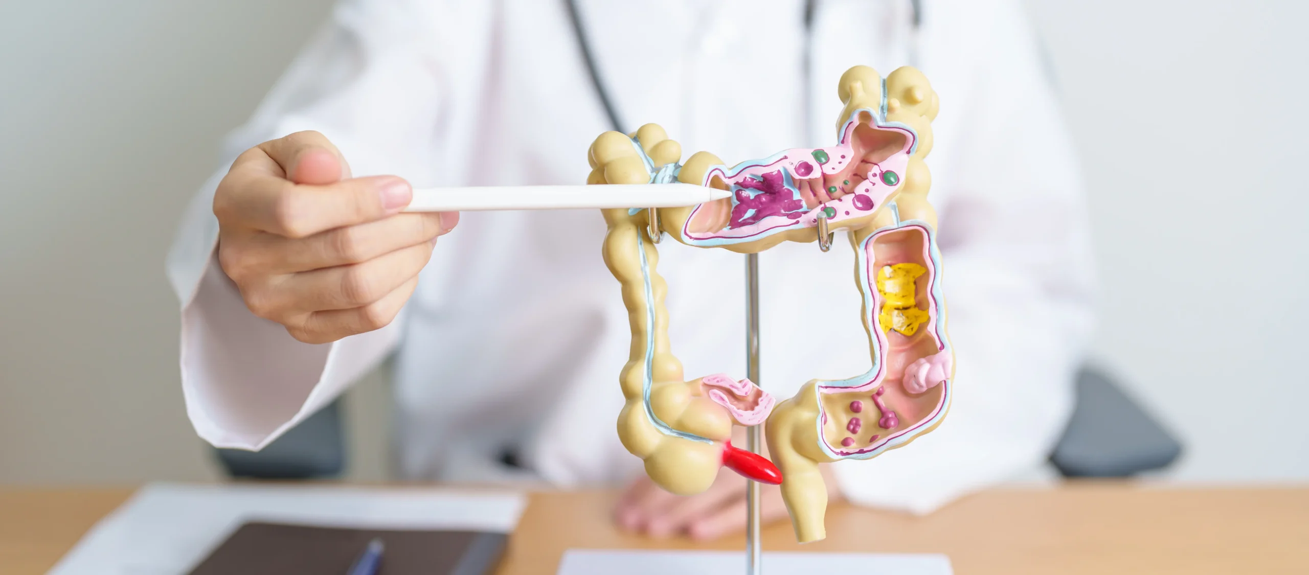 Colon Cancer
