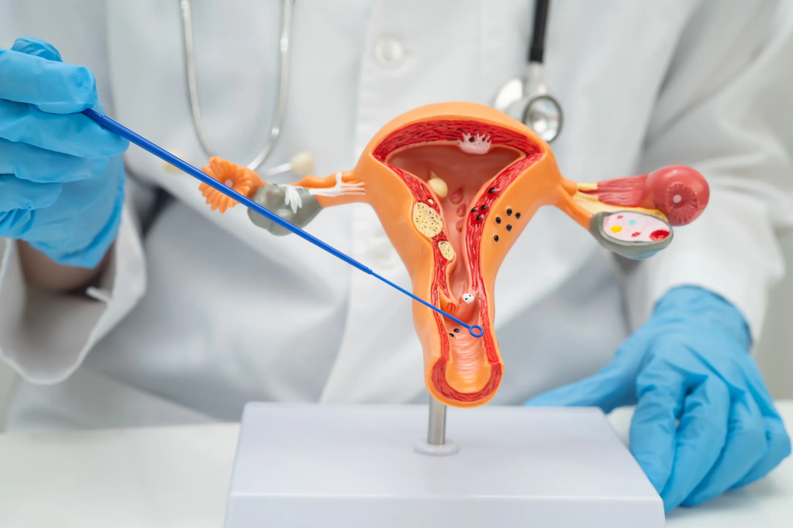 Genital Cancers