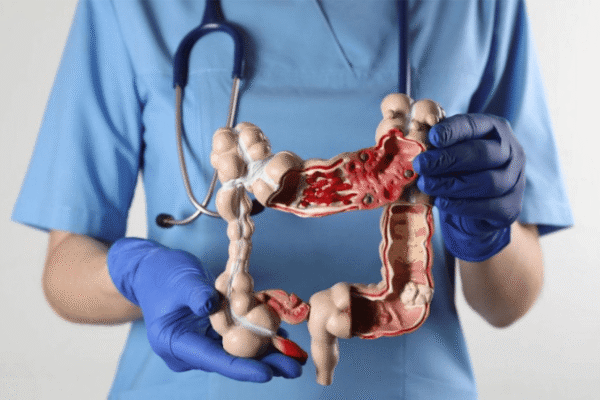 Your Colonoscopy Found Cancer: What Happens Next?
